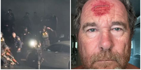 Fotógrafo registra momento em que é atingido por tiro de policial durante protestos nos EUA  Foto: Reprodução/X/@nypost