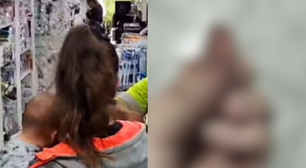 Mulher é agredida por assaltante enquanto amamentava e tem parte do dedo arrancado em mordida