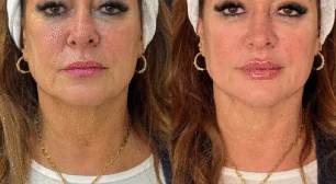 Mãe de Neymar faz rejuvenescimento facil; veja o resultado